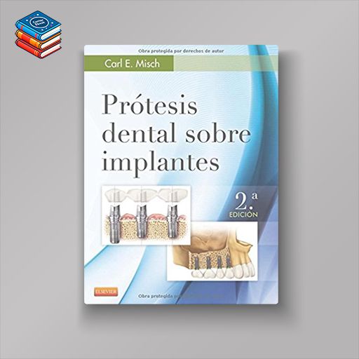 Prótesis dental sobre implantes (Spanish Edition)