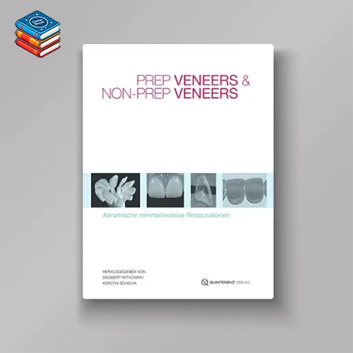 Prep Veneers und Non-Prep Veneers: Keramische minimalinvasive Restaurationen (German Edition) (EPUB)