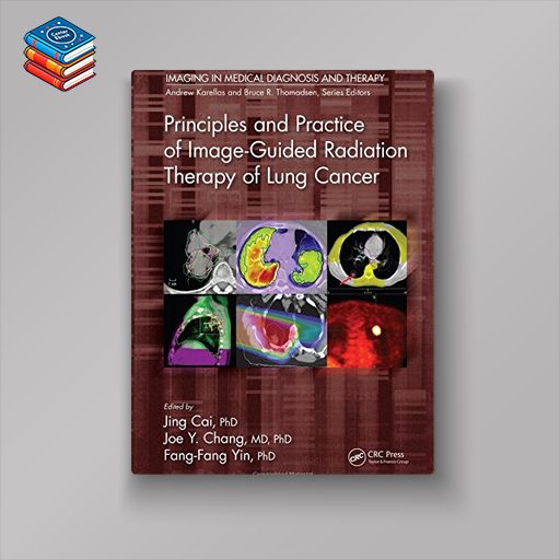 Principles and Practice of Image-Guided Radiation Therapy of Lung Cancer (PDF)