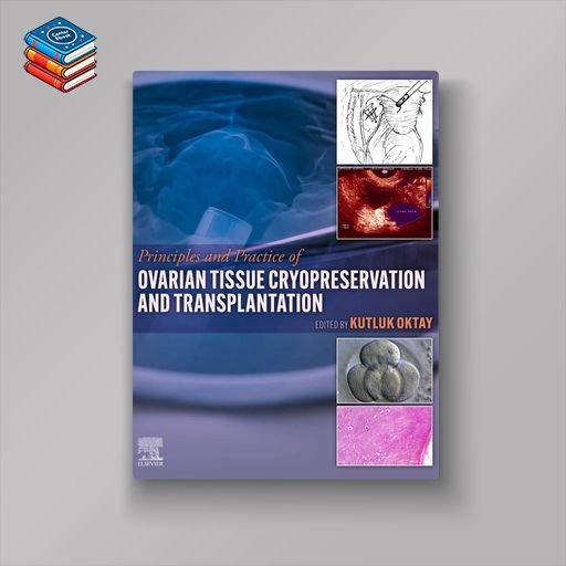 Principles and Practice of Ovarian Tissue Cryopreservation and Transplantation (EPUB)