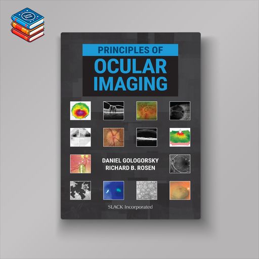 Principles of Ocular Imaging (EPUB)