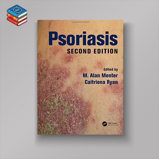 Psoriasis