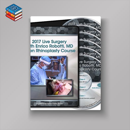 QMP 2017 Live Surgery With Enrico Robotti Open Rhinoplasty Course (Videos)