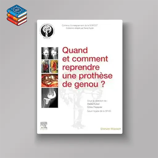 Quand et comment reprendre une prothèse de genou ? (French Edition) (True PDF from Publisher)