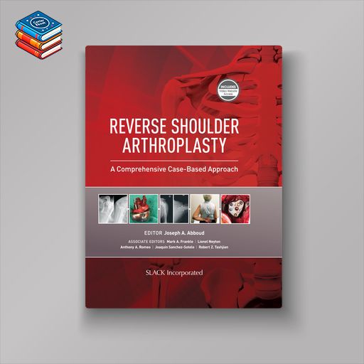 Reverse Shoulder Arthroplasty: A Comprehensive Case-Based Approach (EPUB)