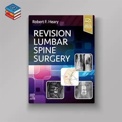 Revision Lumbar Spine Surgery (EPUB)