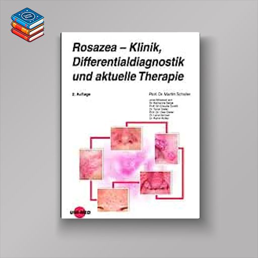 Rosazea – Klinik