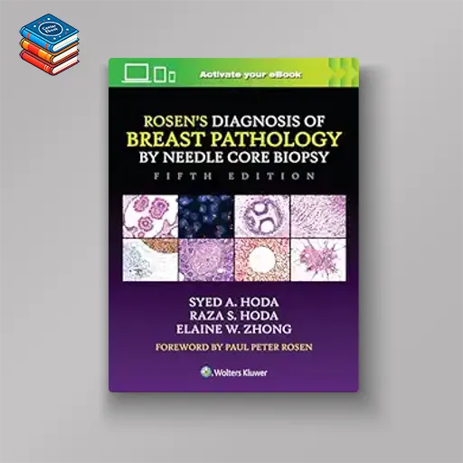 Rosen’s Diagnosis of Breast Pathology by Needle Core Biopsy