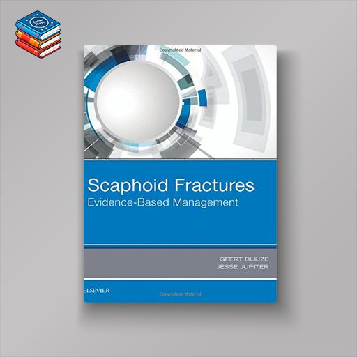 Scaphoid Fractures: Evidence-Based Management