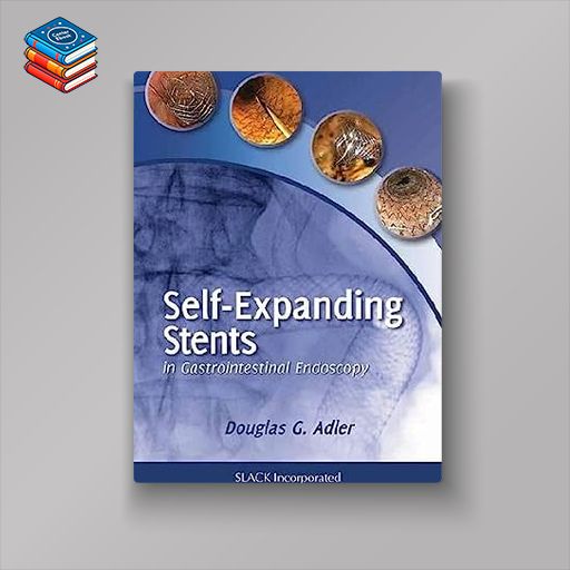 Self-Expanding Stents in Gastrointestinal Endoscopy (Original PDF from Publisher)