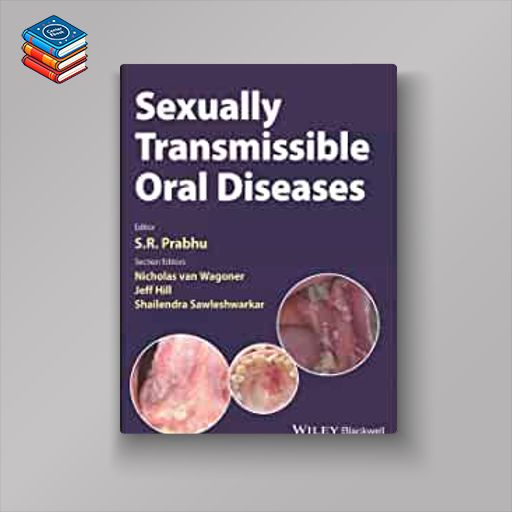 Sexually Transmissible Oral Diseases (EPUB)