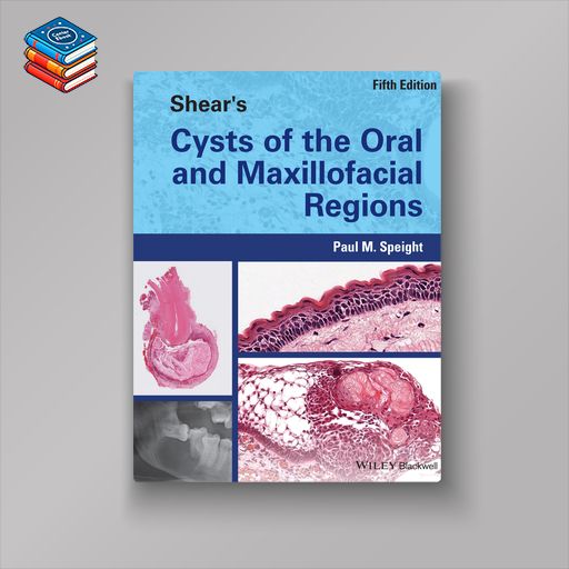 Shear’s Cysts of the Oral and Maxillofacial Regions