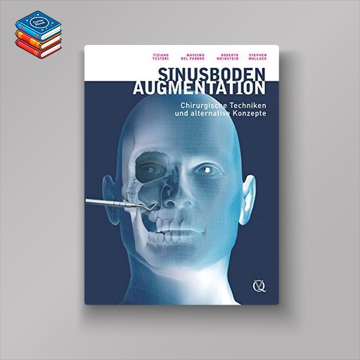 Sinusbodenaugmentation: Chirurgische Techniken und alternative Konzepte (German Edition) (EPUB)