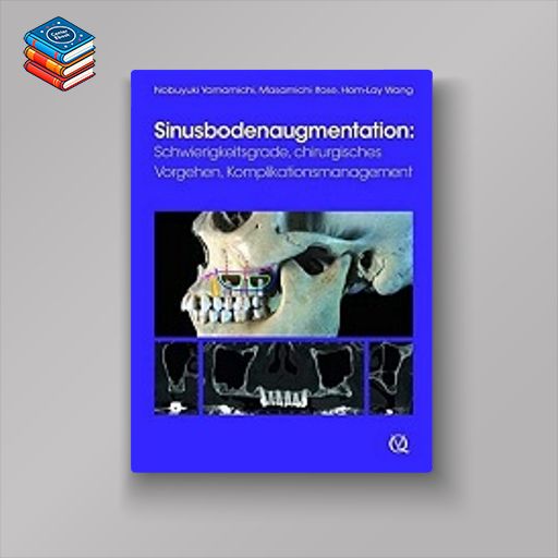 Sinusbodenaugmentation: Schwierigkeitsgrade