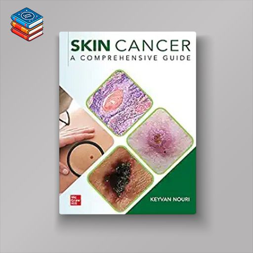 Skin Cancer: A Comprehensive Guide (Original PDF from Publisher)