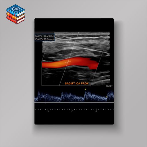 Society for Vascular Medicine Comprehensive Review of Vascular Ultrasound Interpretation and Registry Preparation 2023 (Videos)