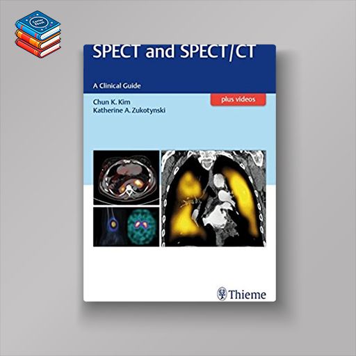 SPECT and SPECT/CT: A Clinical Guide (EPUB)