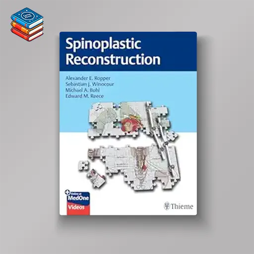 Spinoplastic Reconstruction (Original PDF from Publisher+Videos)