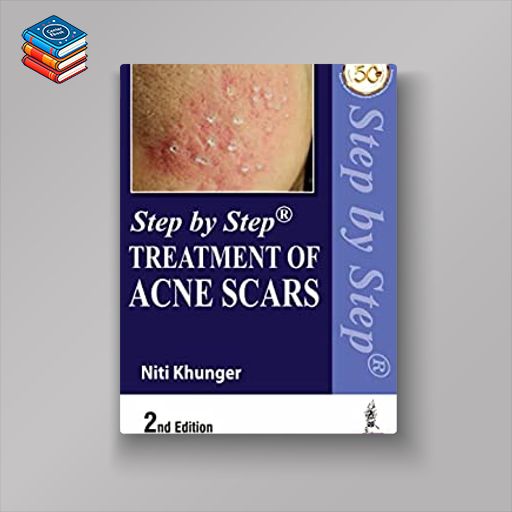 Step by Step Treatment of Acne Scars