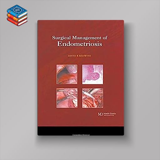 Surgical Management of Endometriosis (Original PDF from Publisher)