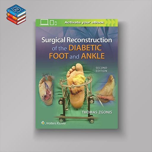 Surgical Reconstruction of the Diabetic Foot and Ankle