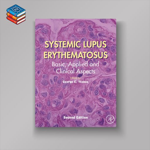 Systemic Lupus Erythematosus: Basic