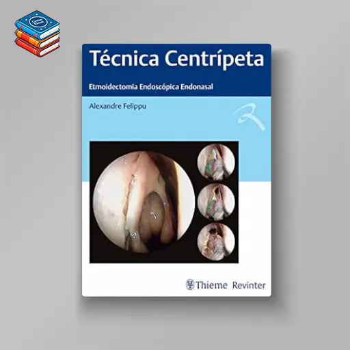 Técnica Centrípeta: Etmoidectomia Endoscópica Endonasal (Portuguese Edition) (EPUB)