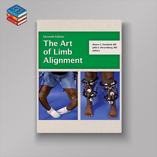 The Art of Limb Alignment