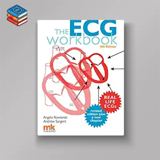 The ECG Workbook