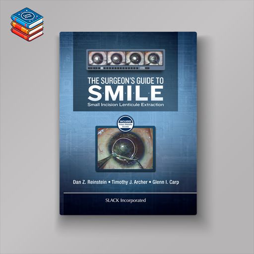 The Surgeon’s Guide to SMILE (Original PDF from Publisher)