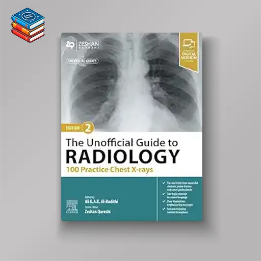 The Unofficial Guide to Radiology: 100 Practice Chest X-rays