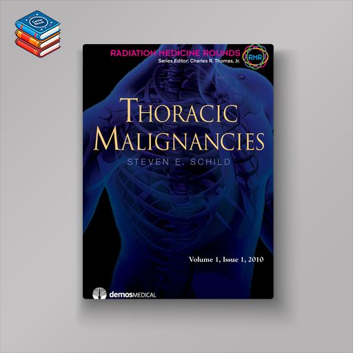 Thoracic Malignancies (Original PDF from Publisher)