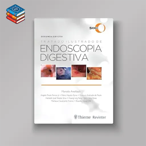 Tratado Ilustrado de Endoscopia Digestiva (Portuguese Edition) (EPUB)