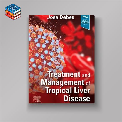 Treatment and Management of Tropical Liver Disease (ePub+Converted PDF)