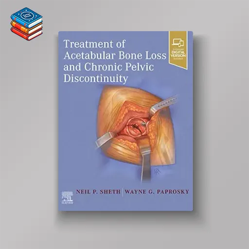 Treatment of Acetabular Bone Loss and Chronic Pelvic Discontinuity (EPUB)