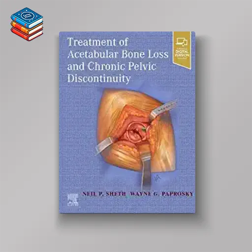 Treatment of Acetabular Bone Loss and Chronic Pelvic Discontinuity (True PDF)