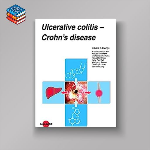 Ulcerative colitis – Crohn’s disease (UNI-MED Science) (Original PDF from Publisher)