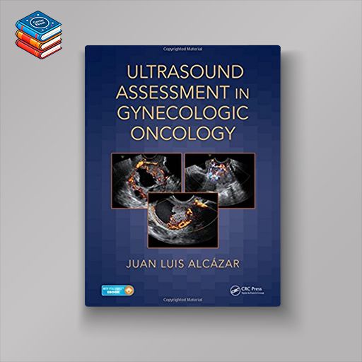 Ultrasound Assessment in Gynecologic Oncology (PDF)