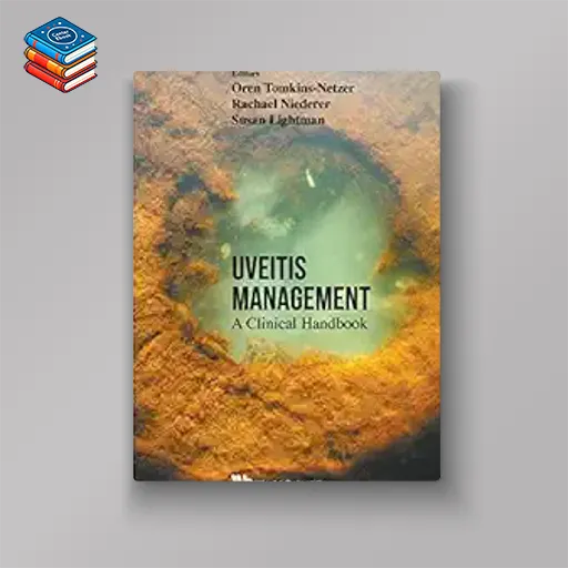 Uveitis Management: A Clinical Handbook (Original PDF from Publisher)