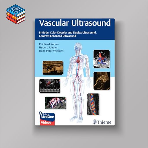 Vascular Ultrasound: B-Mode