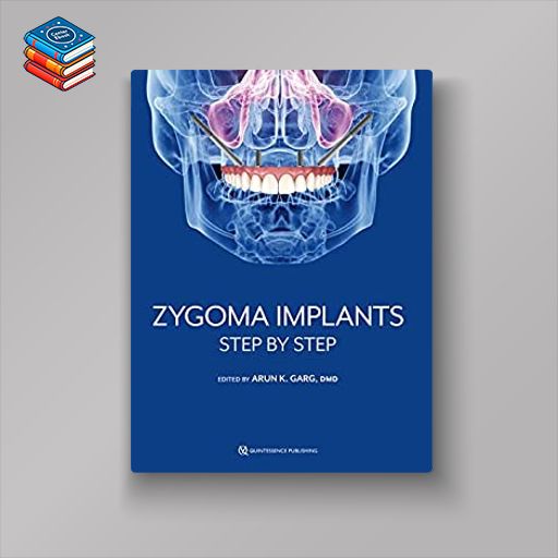 Zygoma Implants: Step by Step (Original PDF from Publisher)